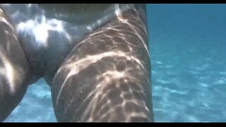 ���ော့ယင်းအတွင်း၊အရေမှာဒေါင်လိုက်ႏွင့္ barra ခြာခြာ